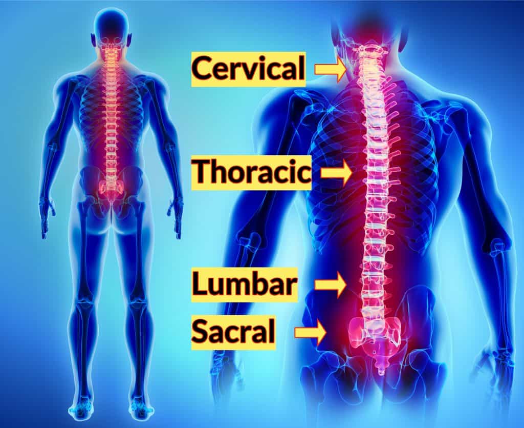 VA Disability Rating For Radiculopathy The Ultimate Guide