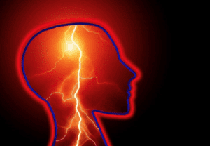 veteran stroke patients