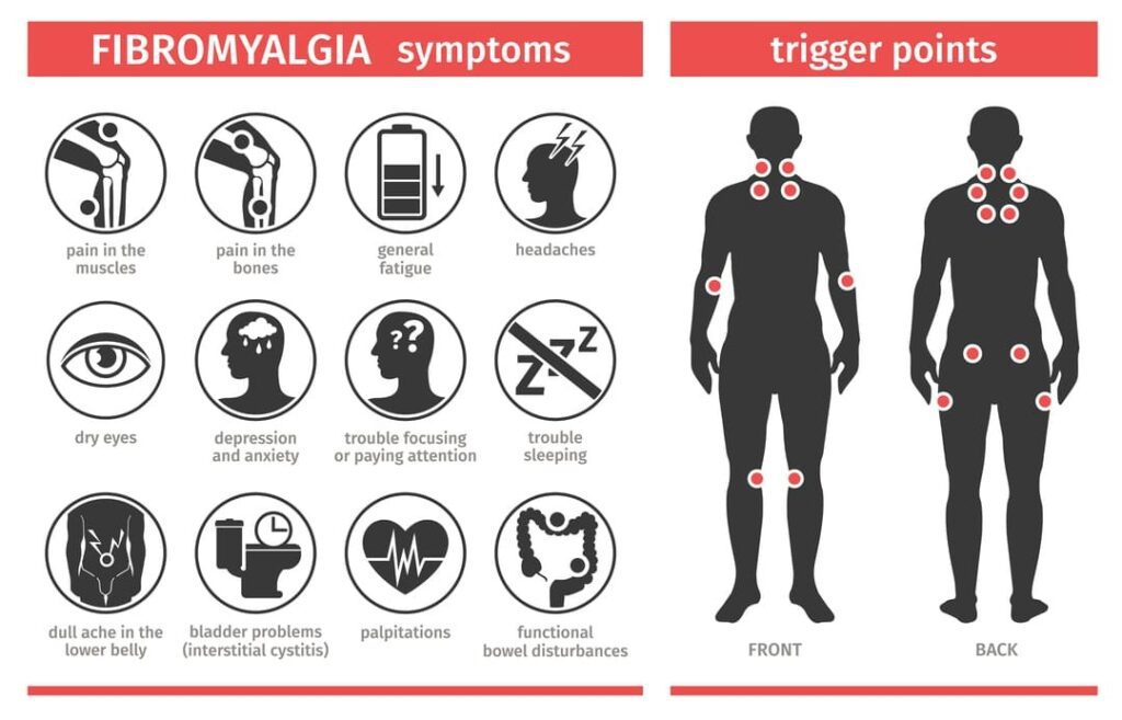 How to Win a Fibromyalgia VA Rating (Ultimate Guide)