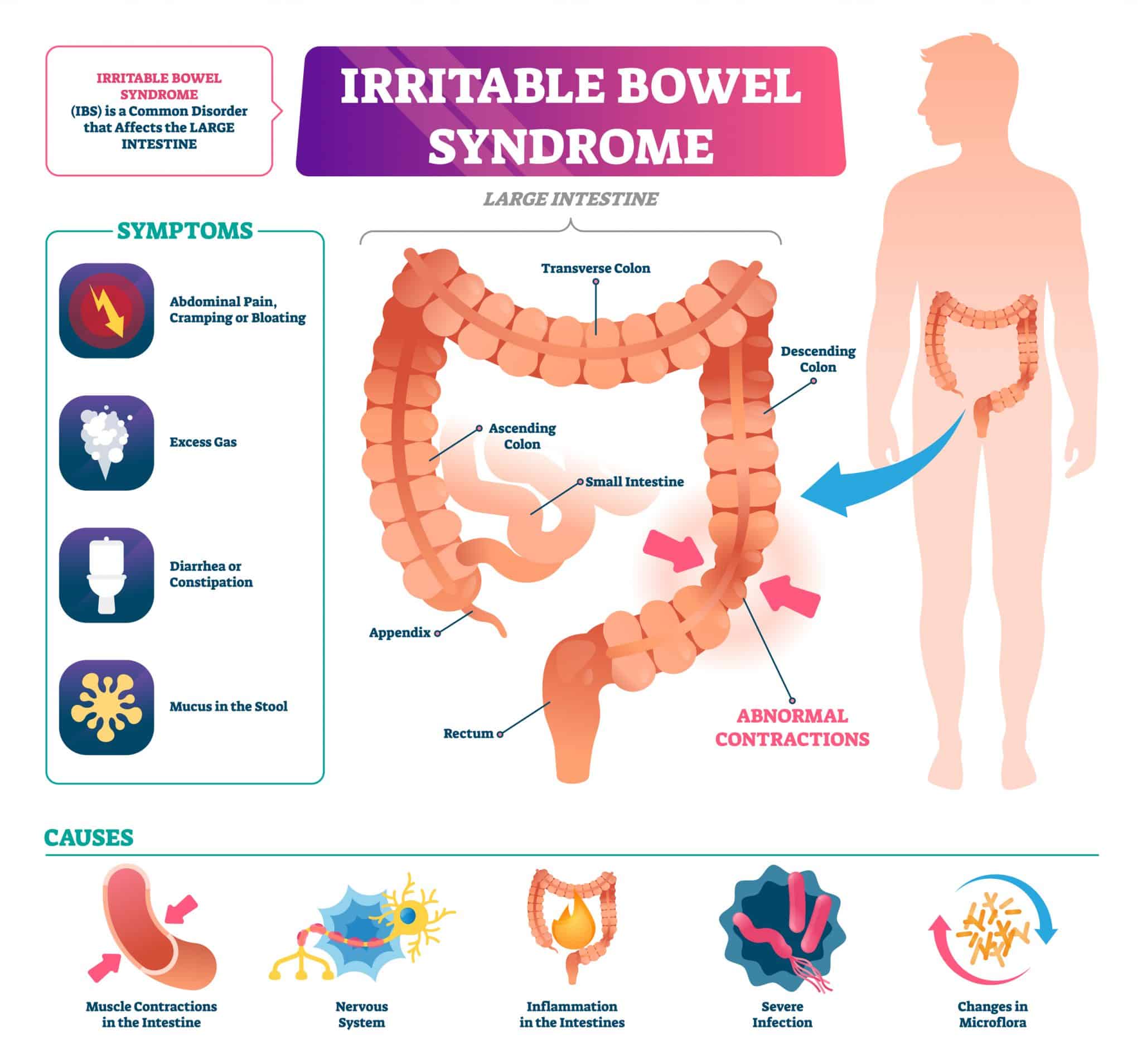 top-3-ibs-va-rating-tips-for-2022-explained-the-expert-s-guide