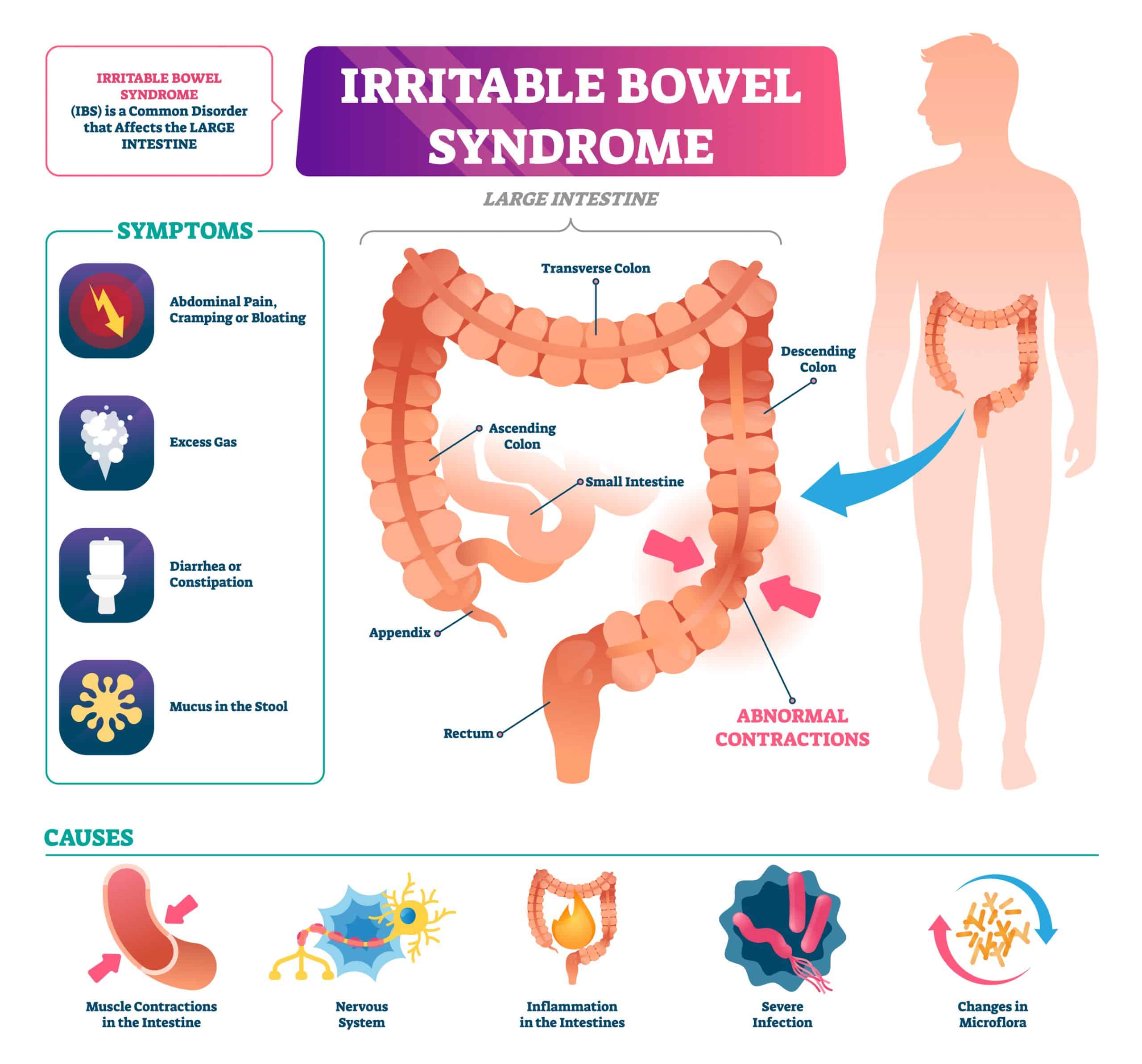 IBS Symptoms in Veterans