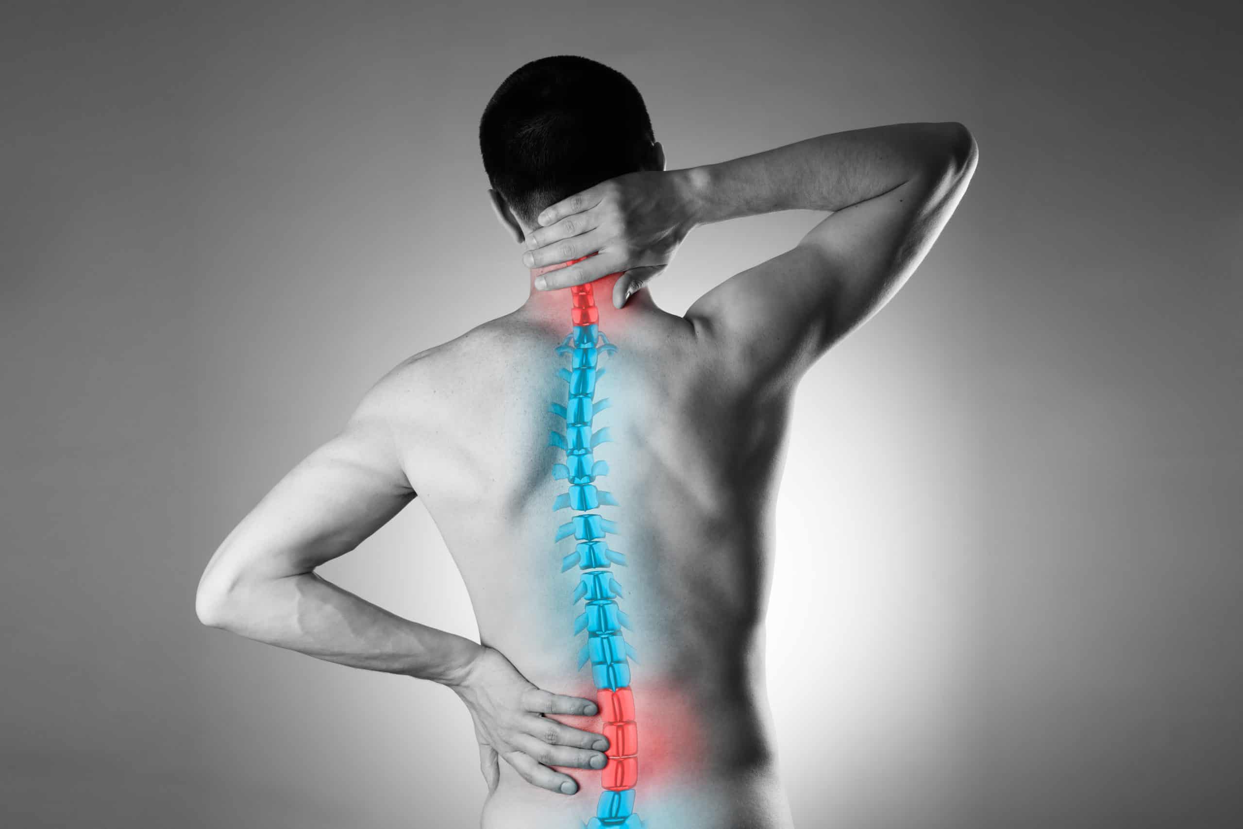 What Is Bilateral Lower Extremity Radiculopathy