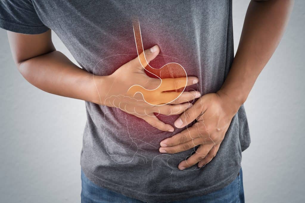VA Disability Rating for IBS