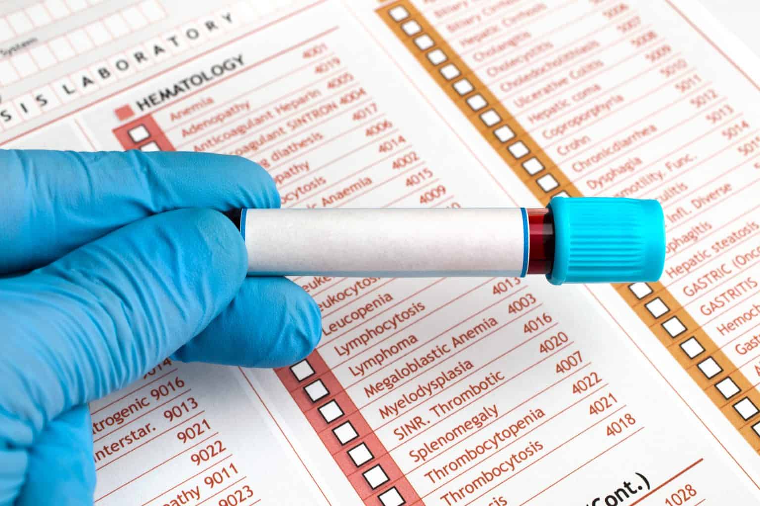 Chronic Fatigue Syndrome VA Rating [2024 Experts Guide]