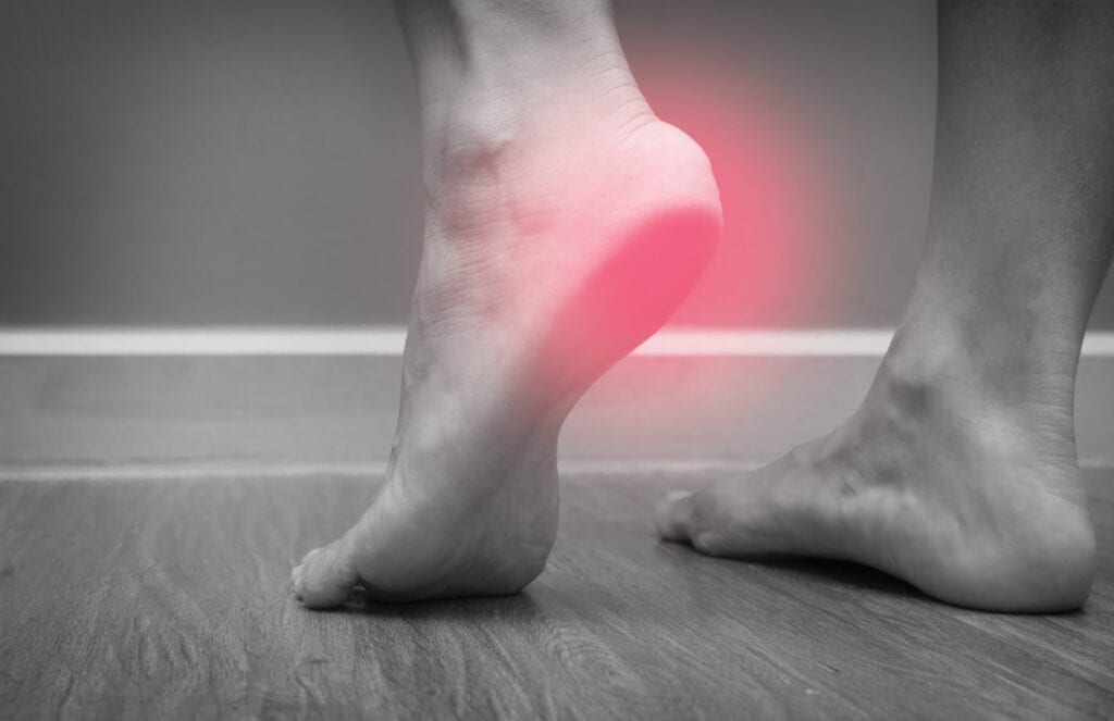 Plantar Fasciitis Secondary Conditions