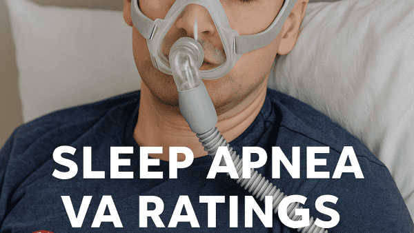 SLEEP APNEA VA RATING.