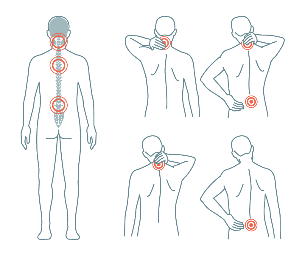 VA Claim for Back Pain