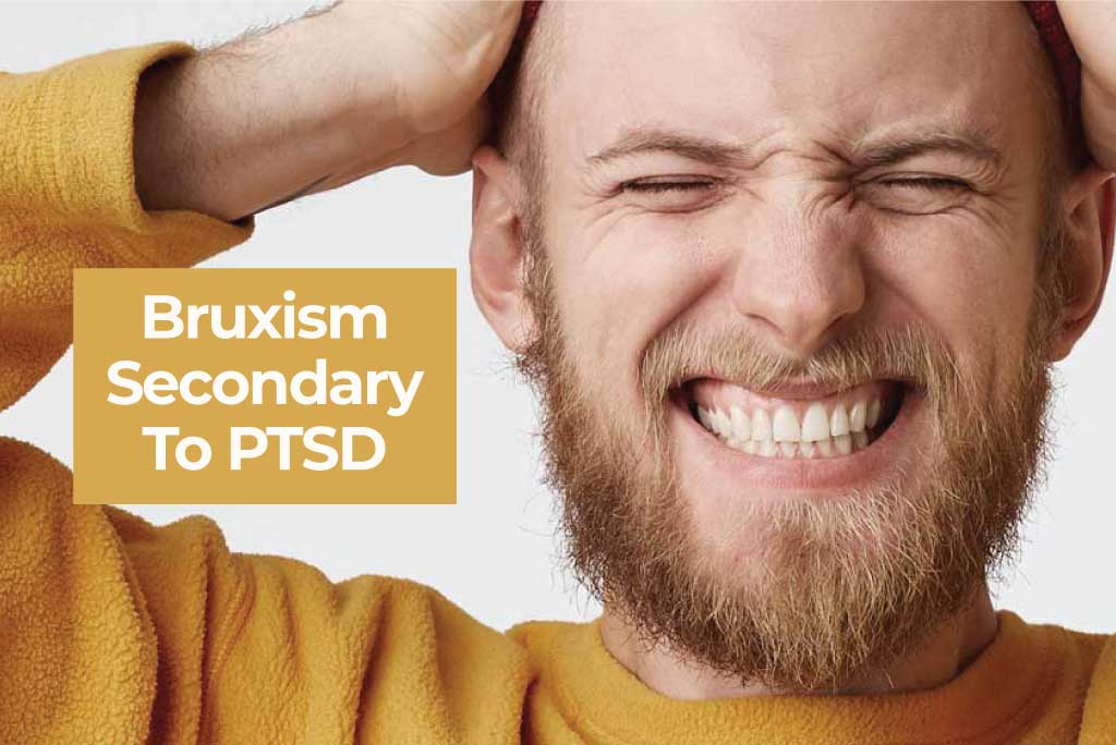 bruxism secondary to ptsd