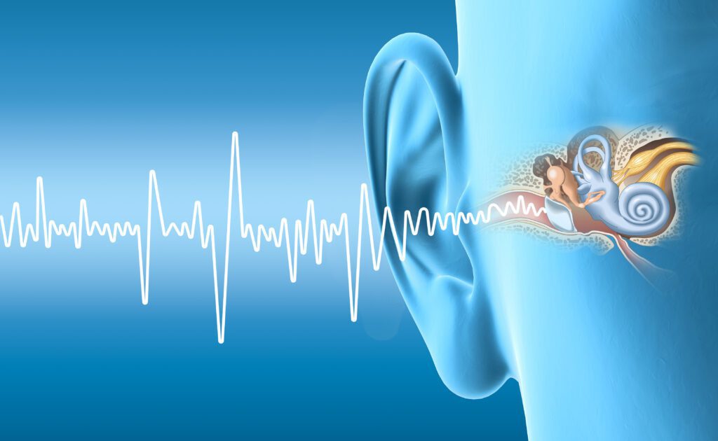 Anxiety Secondary to Tinnitus VA Disability