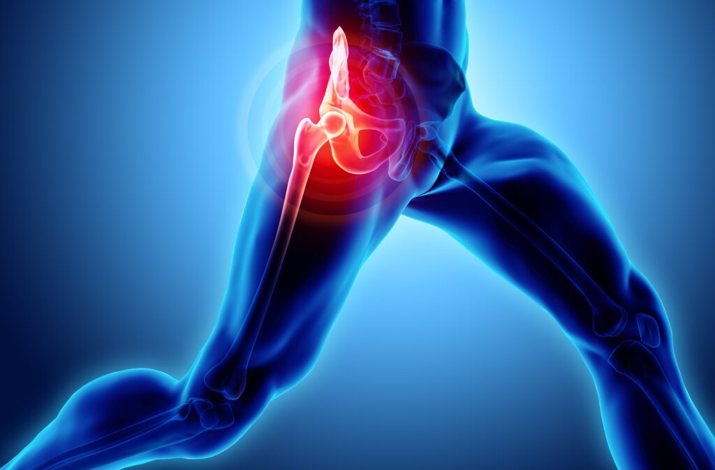 Orthopedic Conditions Secondary to Knee Pain