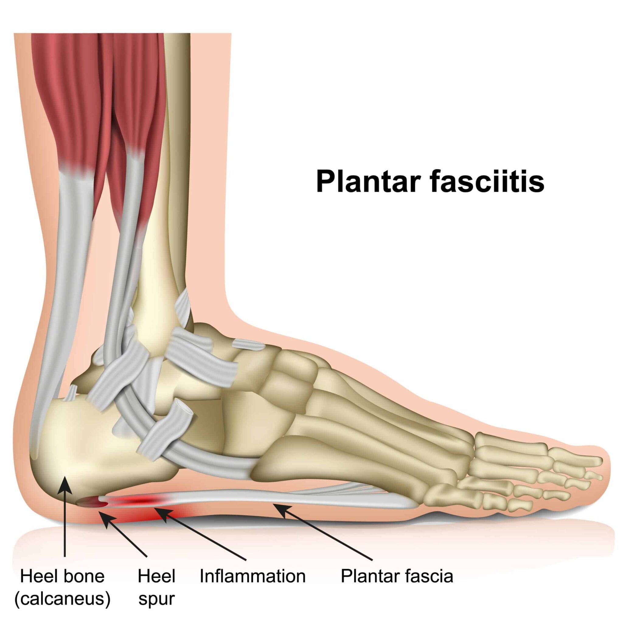 Top 5 VA Secondary Conditions to Knee Pain (The Insider’s Guide)