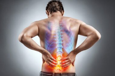 What is the VA Rating for Degenerative Disc Disease
