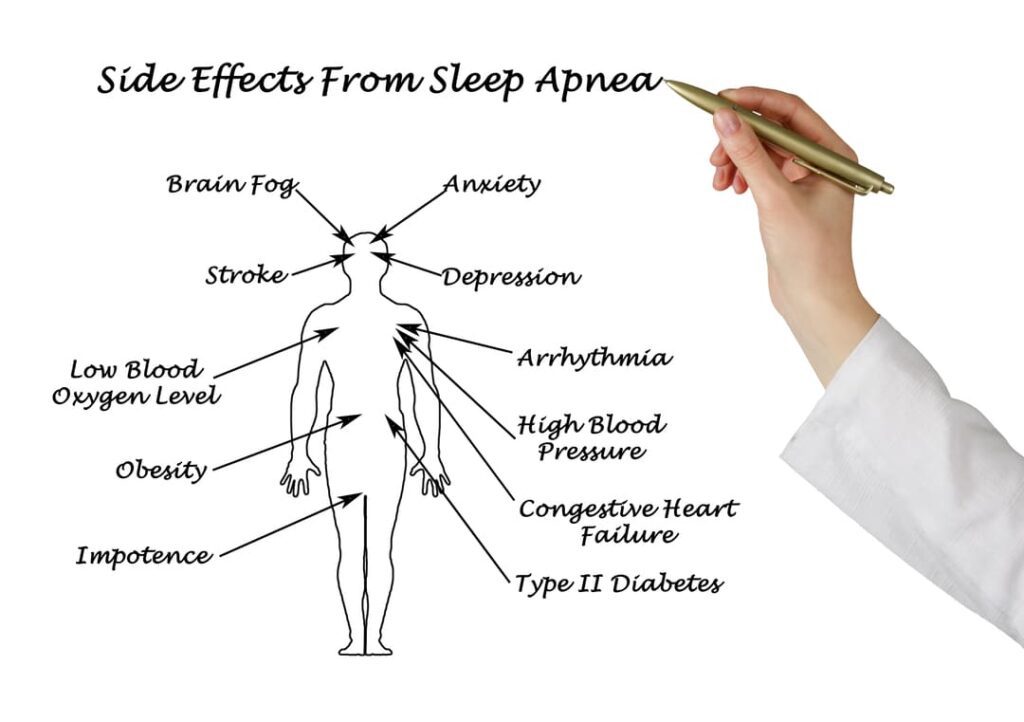 va rating for sleep apnea secondary to ptsd