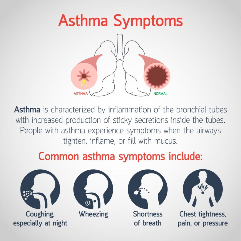 Asthma is a common VA disability claim