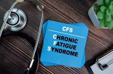 Chronic fatigue syndrome va presumptive