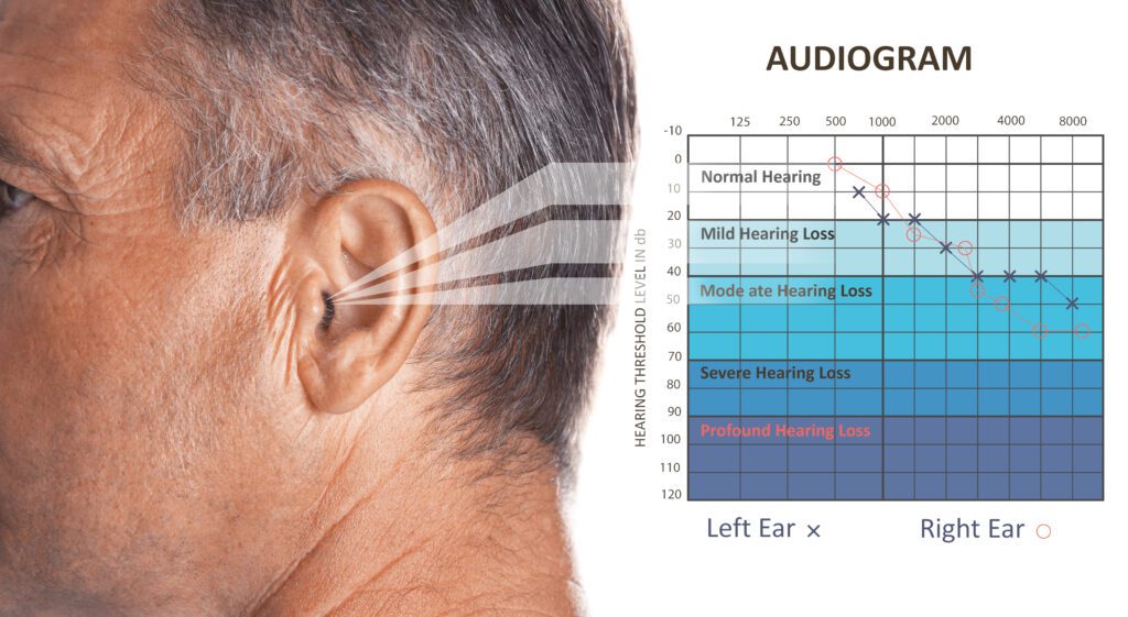 Hearing Loss is the second most common VA claim