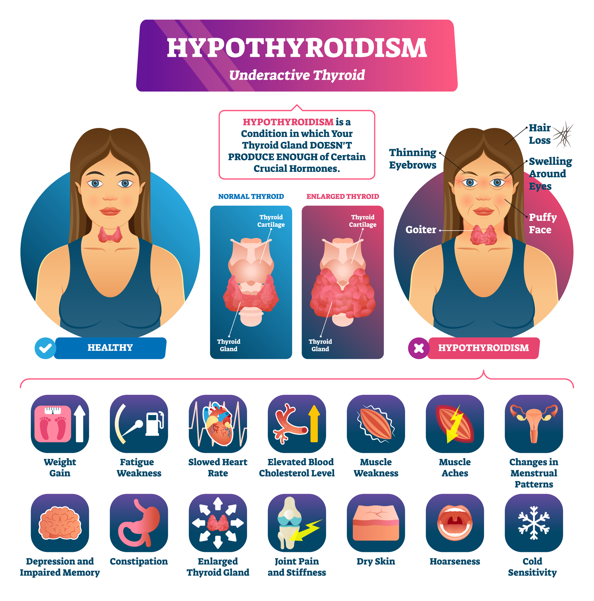 Hypothyroidism VA Claim