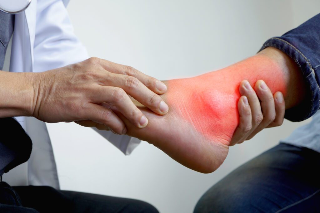 Limited Range of Motion of the Ankle is the 8th most common VA claim