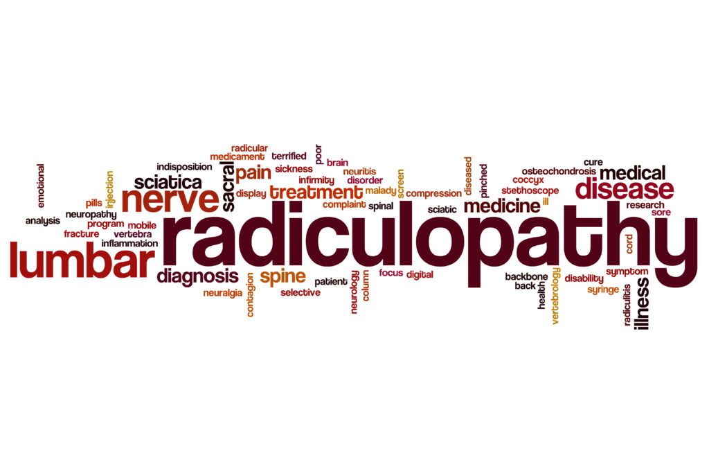 Radiculopathy is one of the Top 20 VA Disability Claims