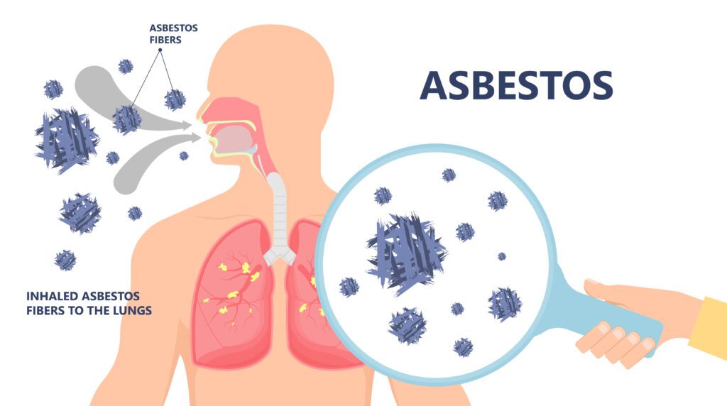 Asbestos Exposure VA Disability