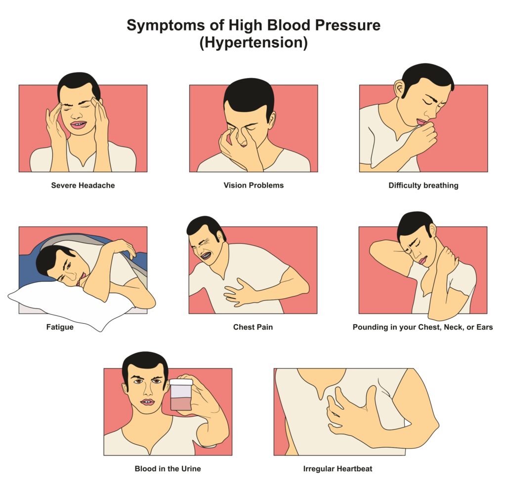 Common Signs and Symptoms of High Blood Pressure