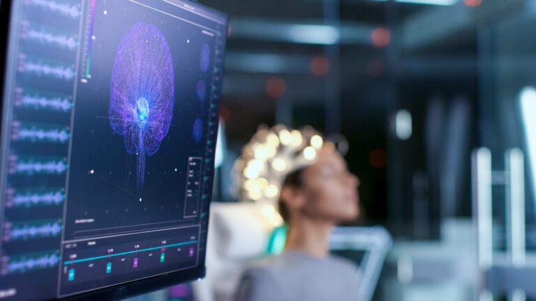 Getting The Highest TBI VA Rating [Ultimate Guide]