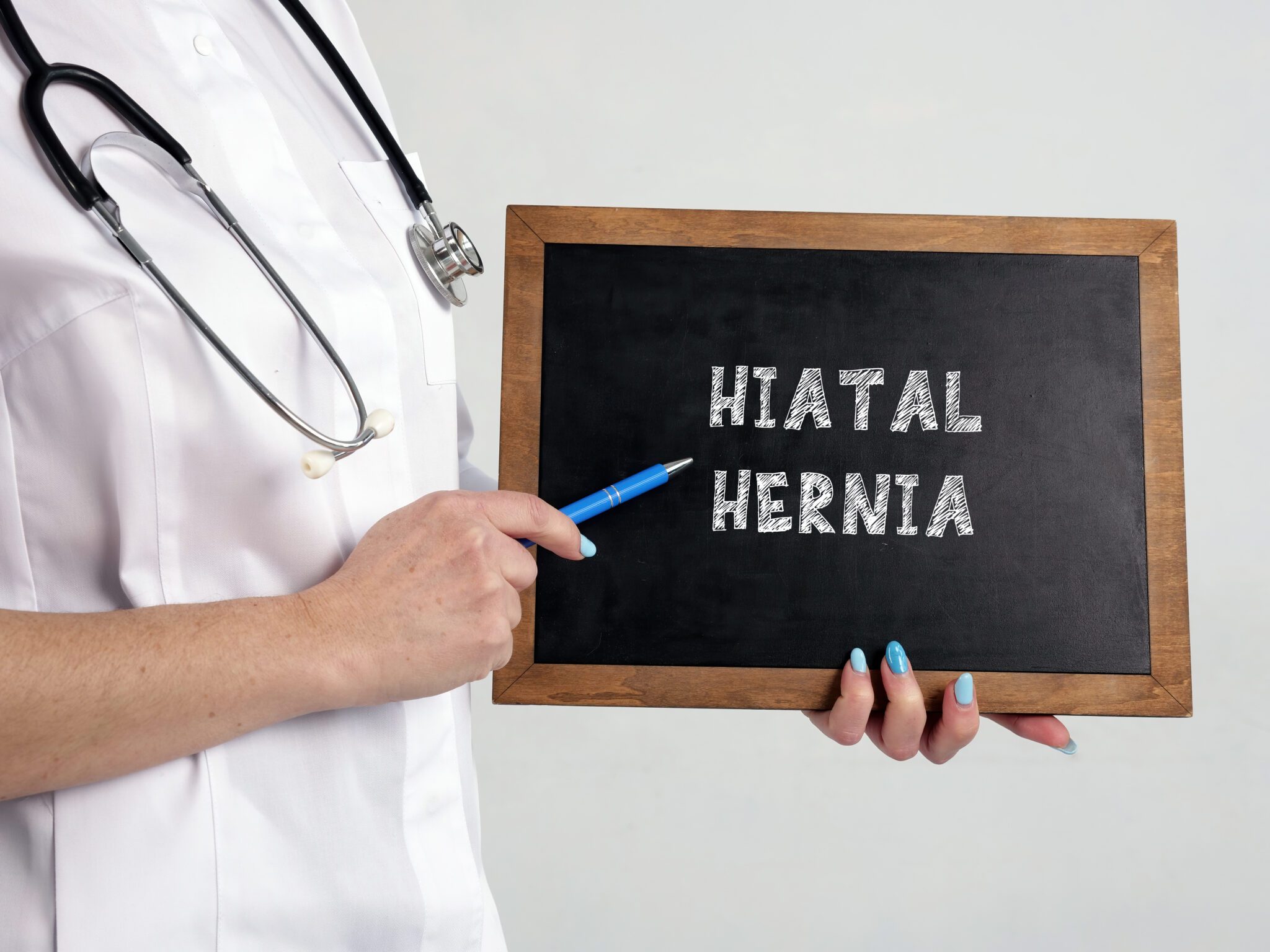 Top 3 Ways to Get a Hiatal Hernia VA Rating (The Insider’s Guide)