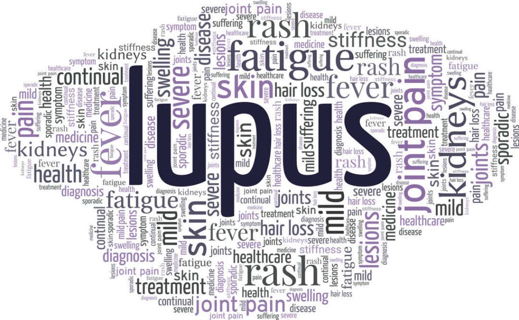 VA BENEFITS FOR VETERANS WITH LUPUS