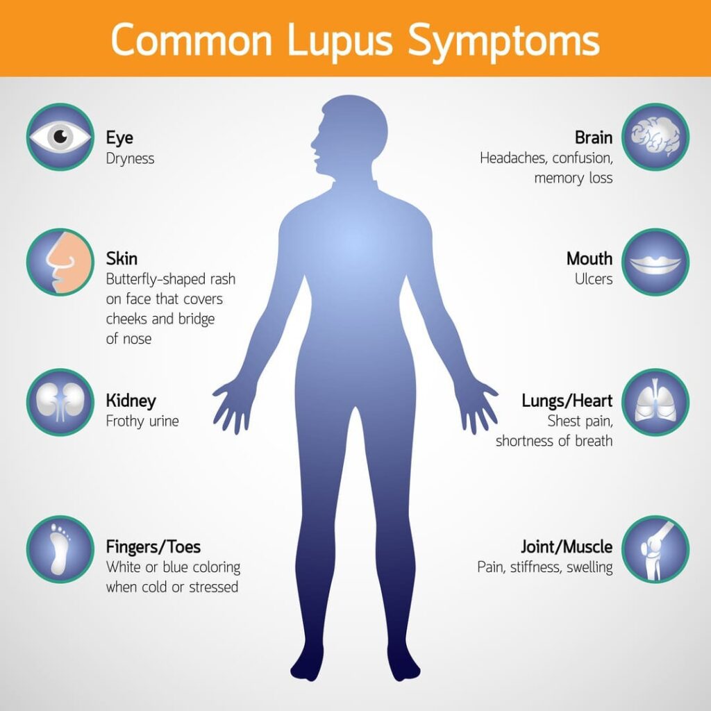 VA BENEFITS LUPUS