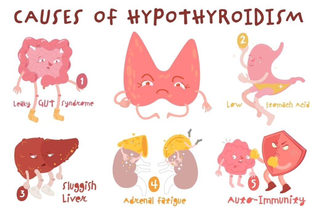 HYPOTHYROIDISM VA RATING