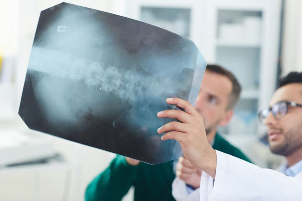 SECONDARY CONDITIONS TO DEGENERATIVE DISC DISEASE