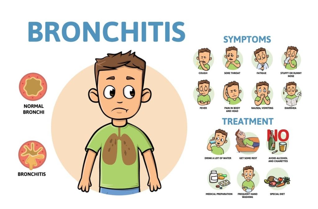 VA DISABILITY FOR BRONCHITIS