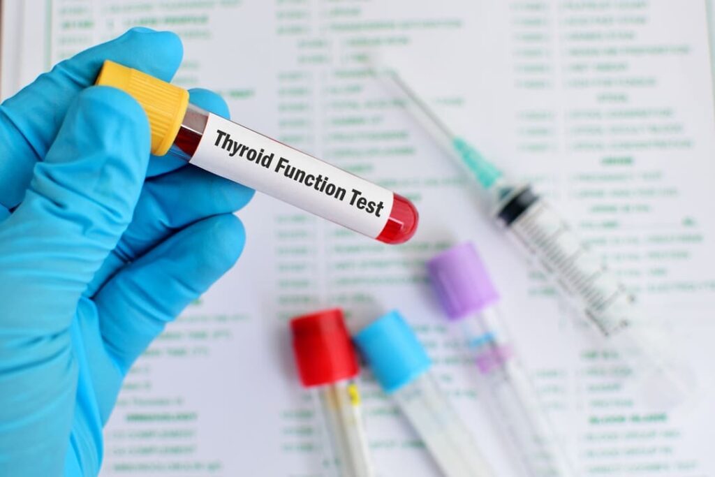 VA DISABILITY RATING FOR HYPOTHYROIDISM.