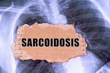 SARCOIDOSIS VA RATING