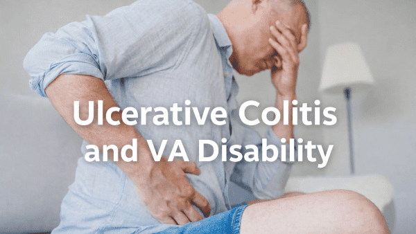 ULCERATIVE COLITIS VA RATING.