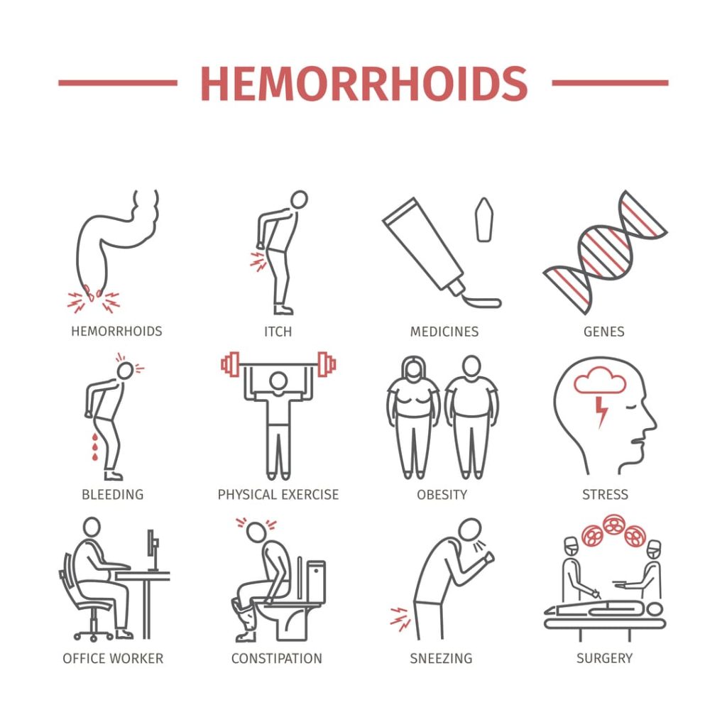 VA RATING FOR HEMORRHOIDS SECONDARY TO IBS 1