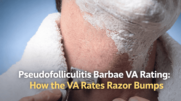 PSEUDOFOLLICULITIS BARBAE VA RATING.