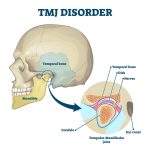 4 Mistakes to Avoid When Filing for a TMJ VA Rating