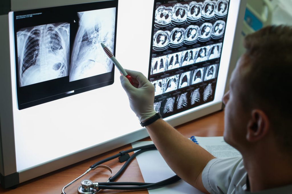 VA DOCTOR VIEWING CHEST XRAY