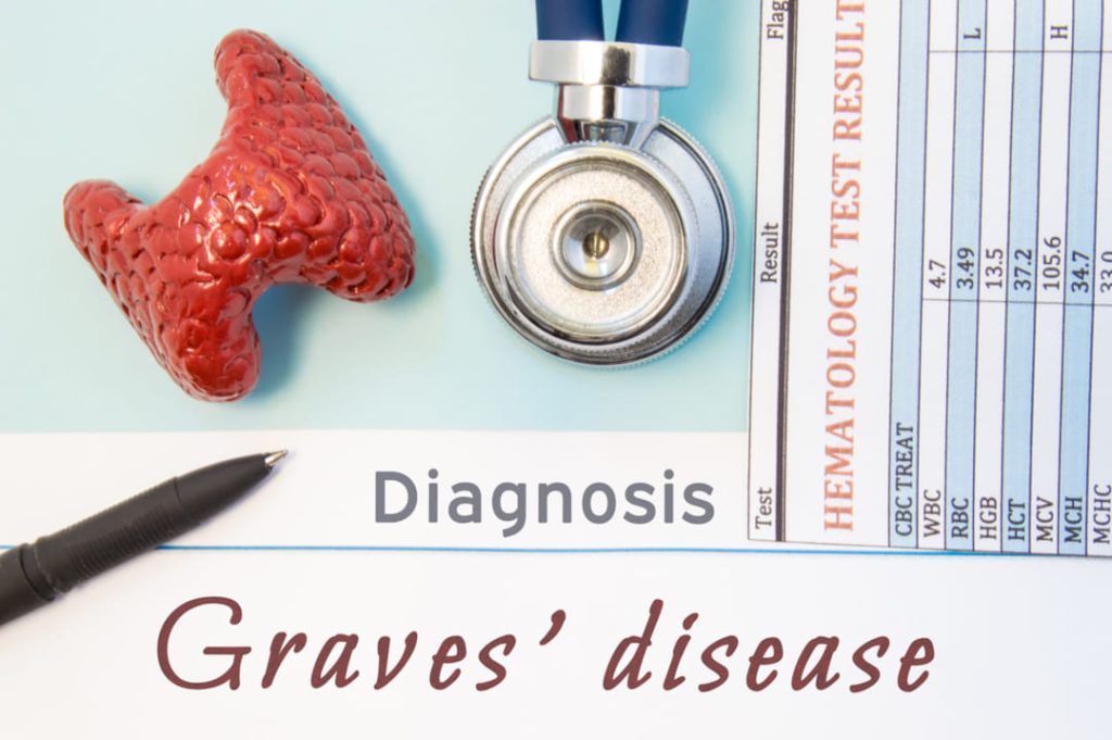 GRAVES DISEASE diagnosis graphic.