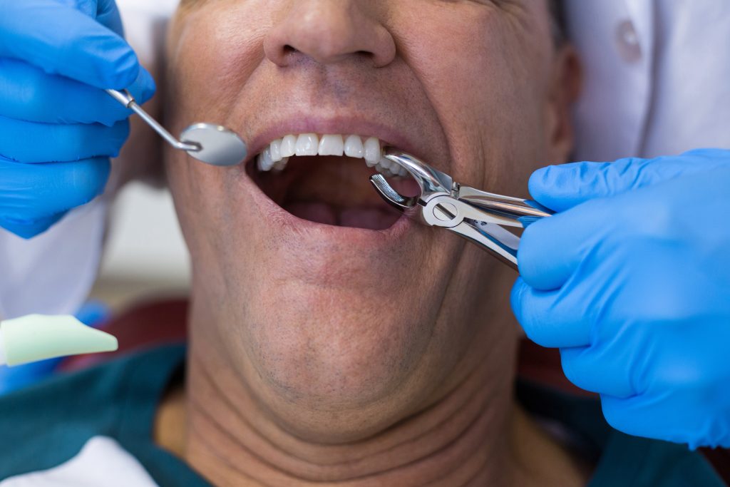 VA disability for tooth extraction
