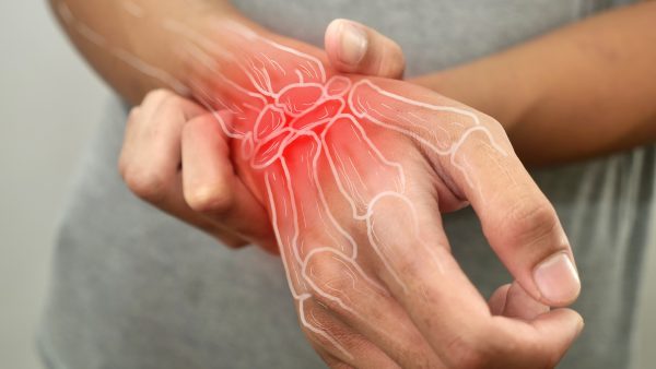 How to Get VA Disability for Wrist Conditions
