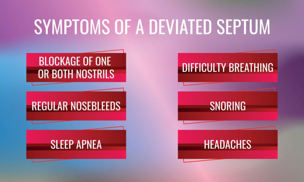 Infographic showing symptoms of a deviated septum.