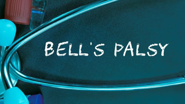 Bells Palsy VA Ratings.