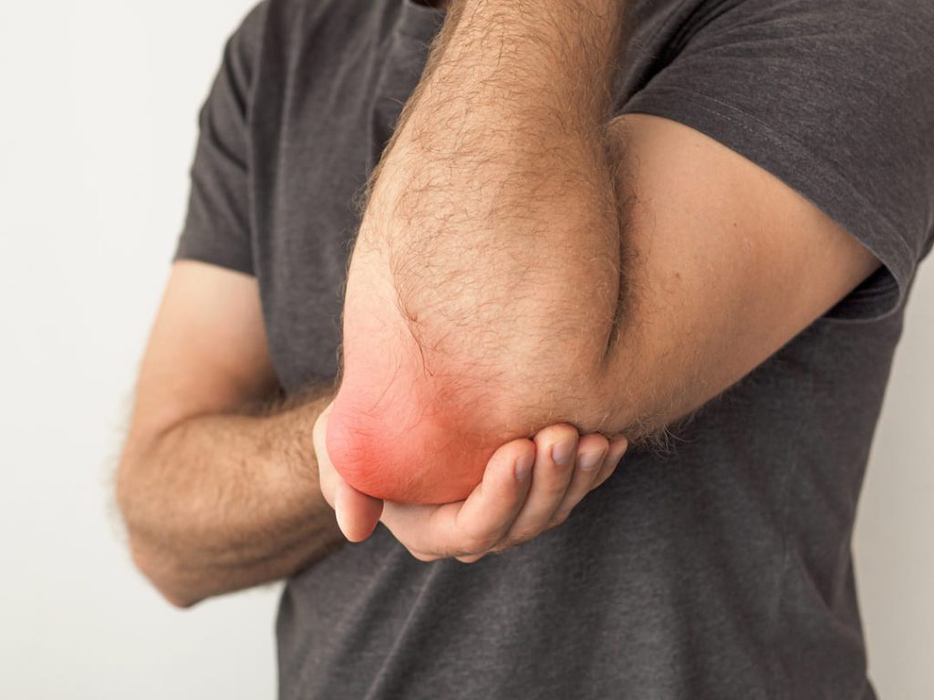 Man holding his elbow bursitis.