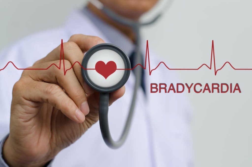 BRADYCARDIA VA DISABILITY RATING