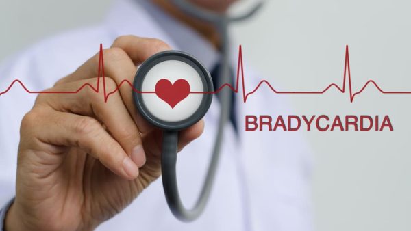 BRADYCARDIA VA DISABILITY RATING.