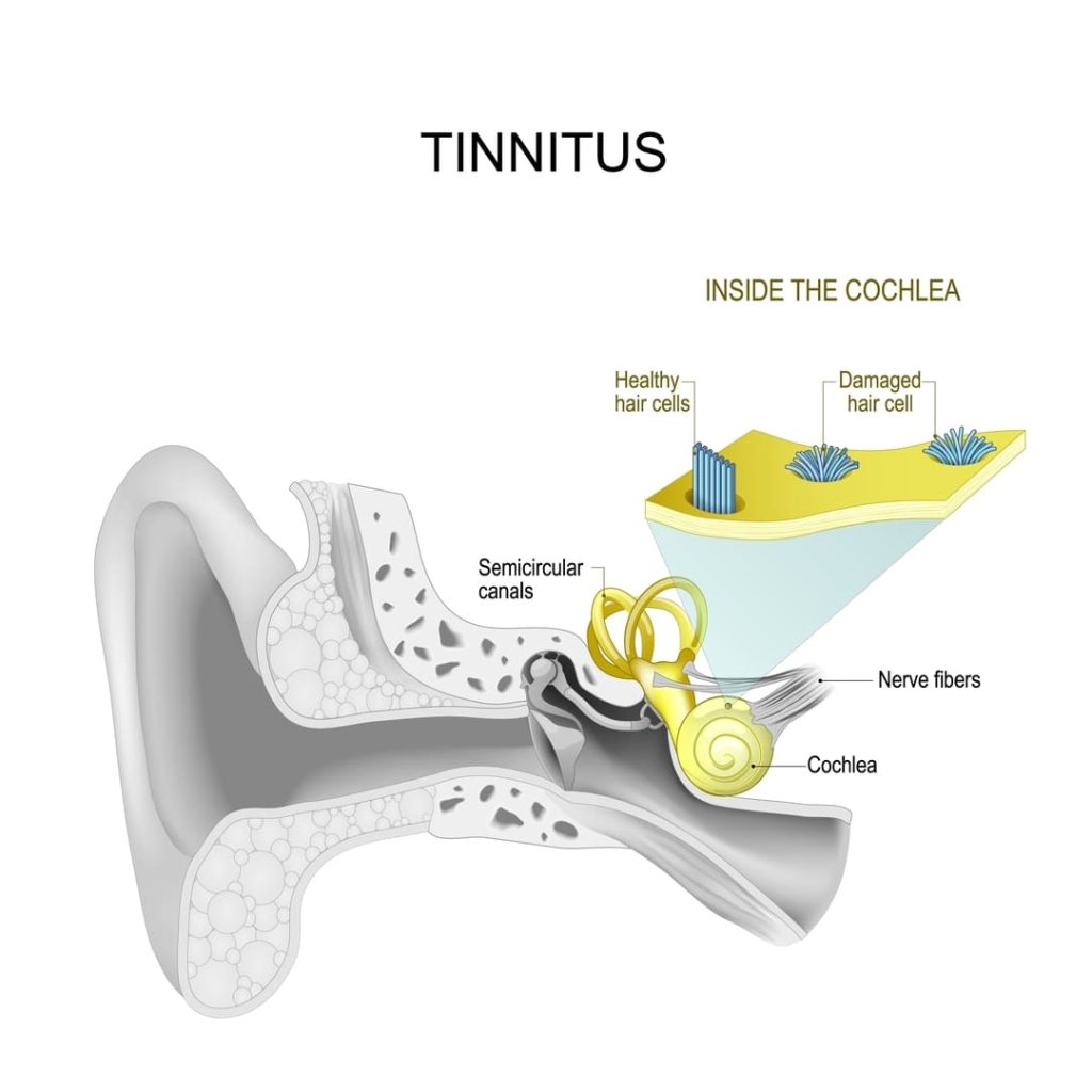 va tinnitus rating change