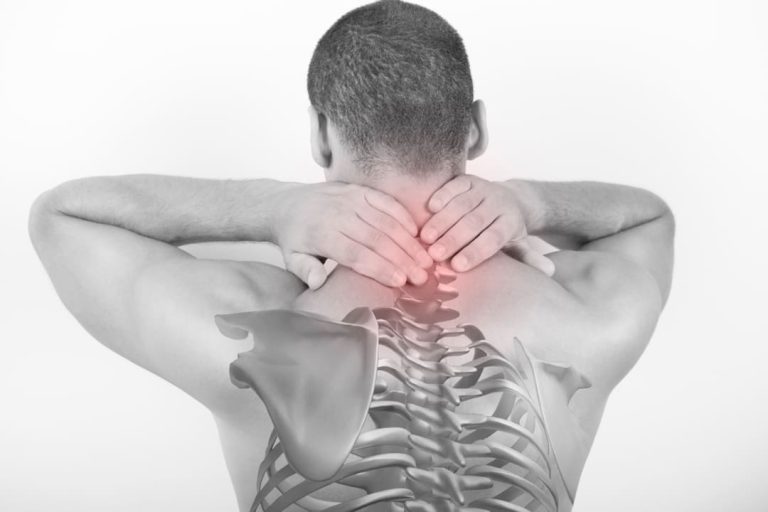 How to Get a Neck Pain VA Rating (Up to 100)