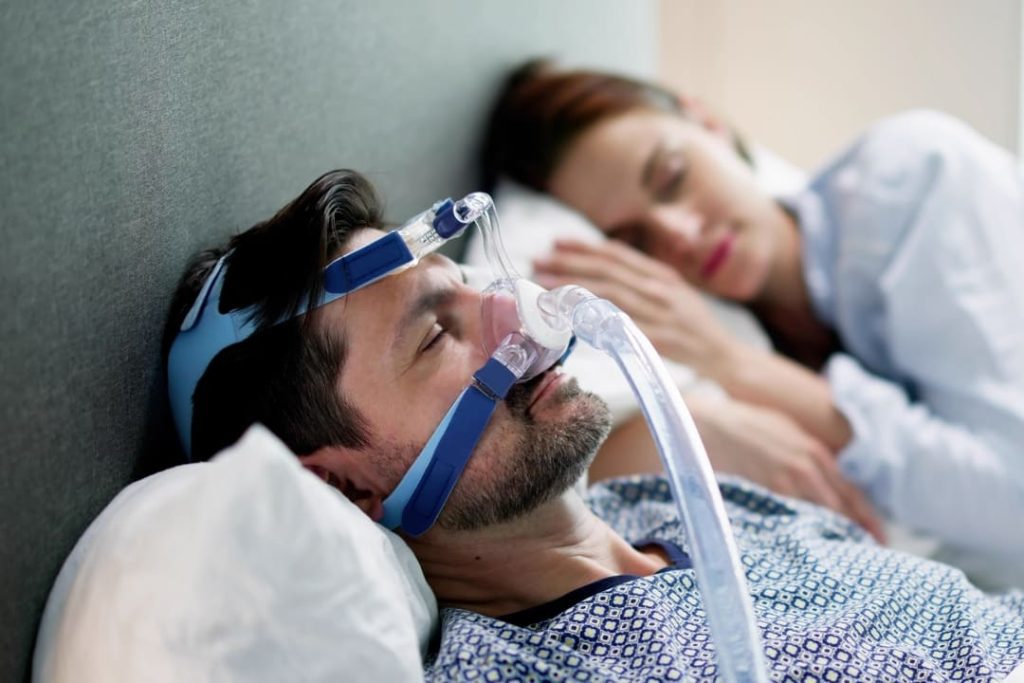 SLEEP APNEA SECONDARY TO RHINITIS